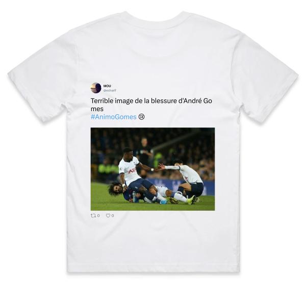 Post: Terrible image de la blessure d'André Gomes  #AnimoGomes 😢